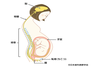 無痛分娩（計画無痛分娩）について